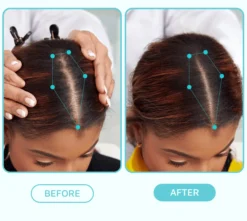 Scalp Fixer